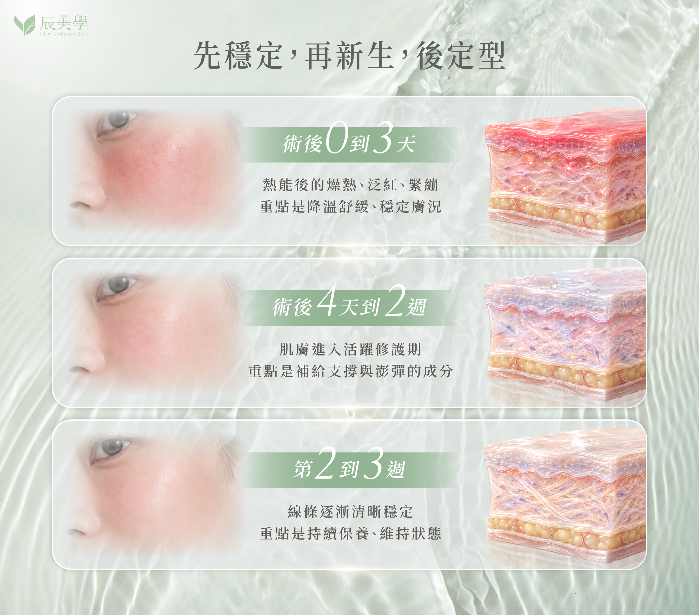 音波術後三週三階段保養重點時間軸＿辰美學