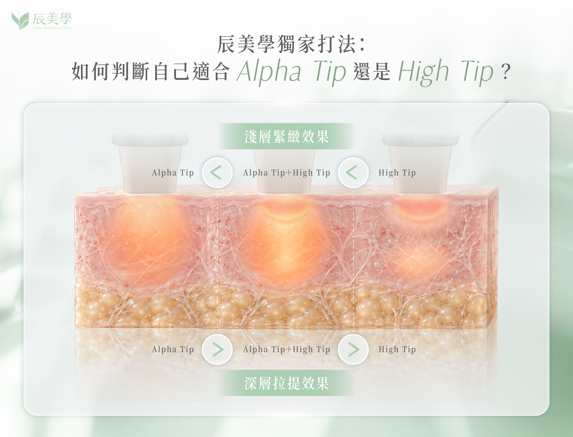 無雙電波辰美學獨家打法＿辰美學