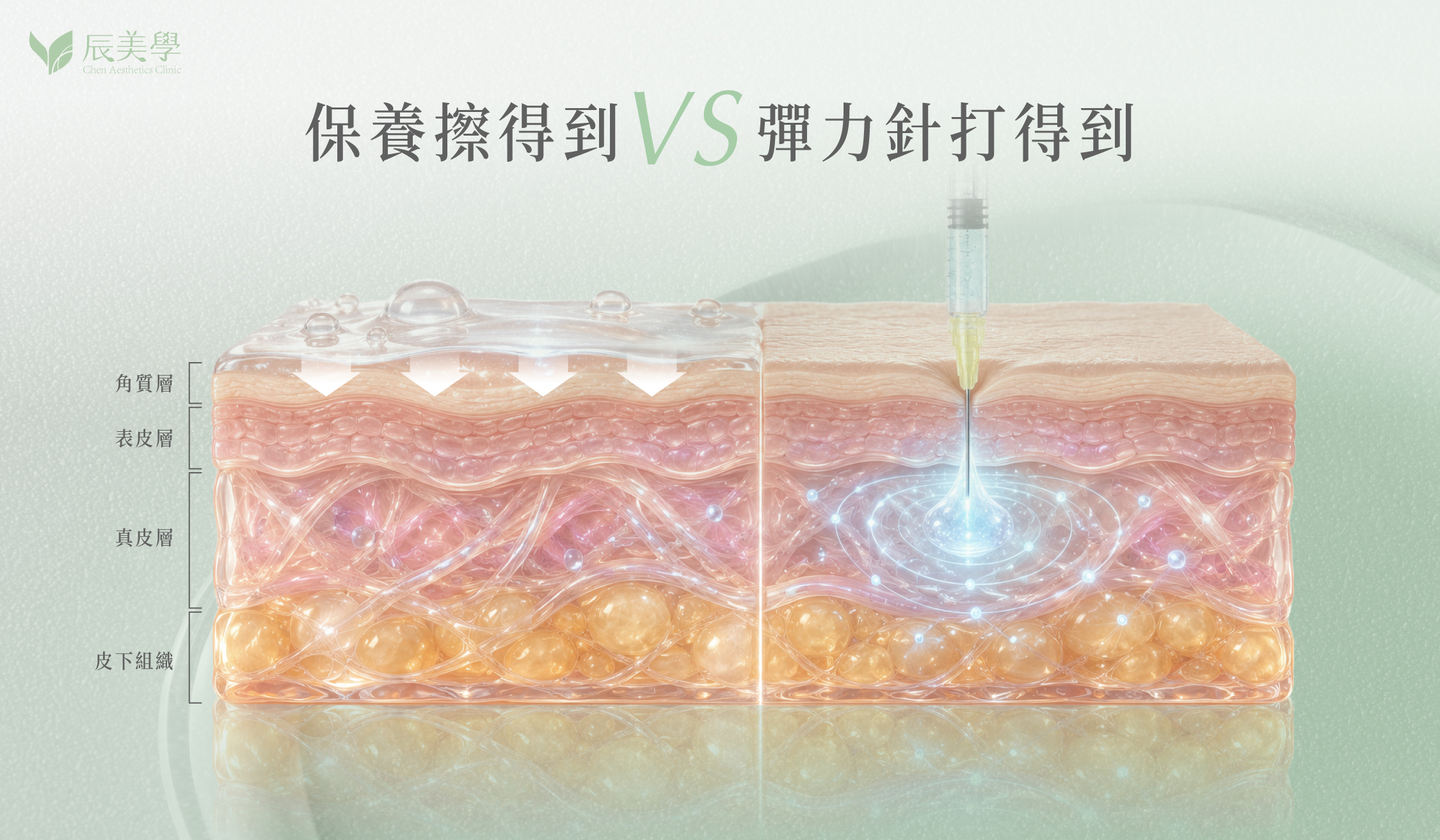 為什麼彈力針可以打到真皮層＿辰美學