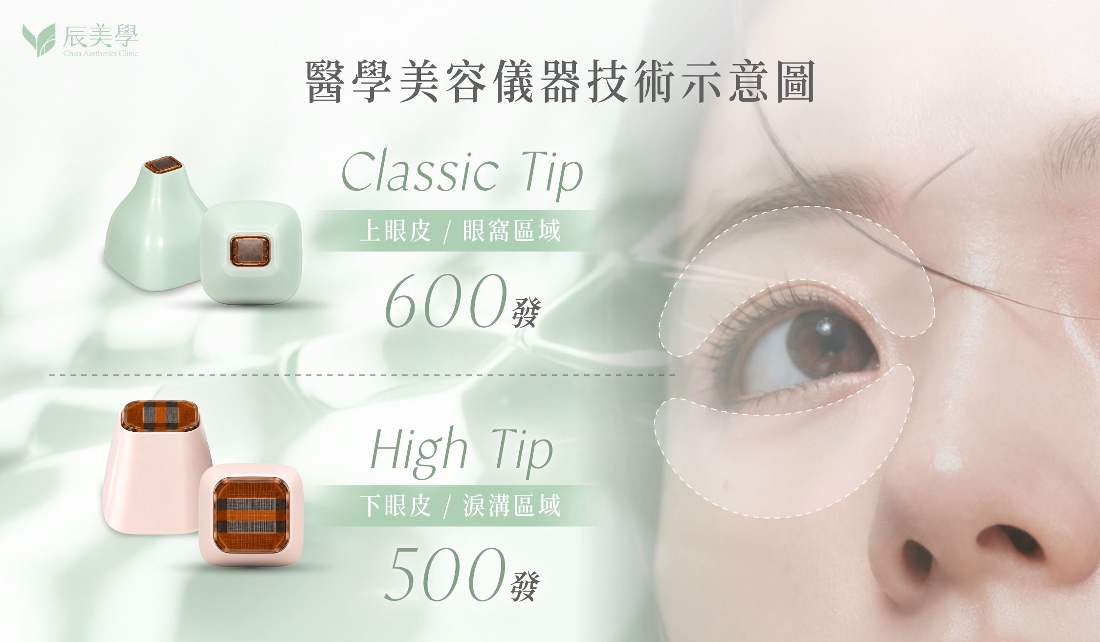 無雙電波眼周探頭Classic Tip怎麼打最有感＿辰美學