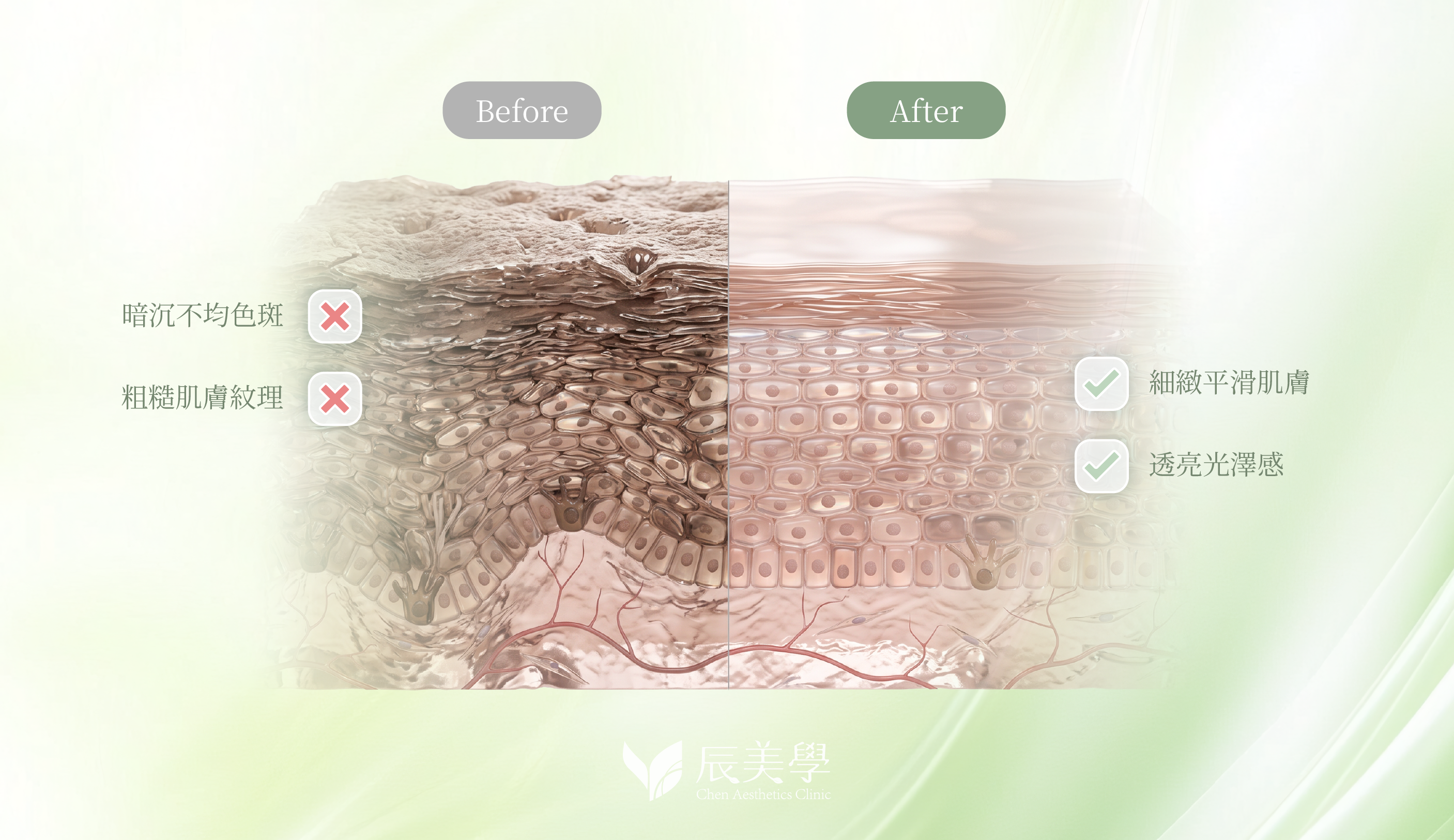 picosure755皮秒雷射_辰美學