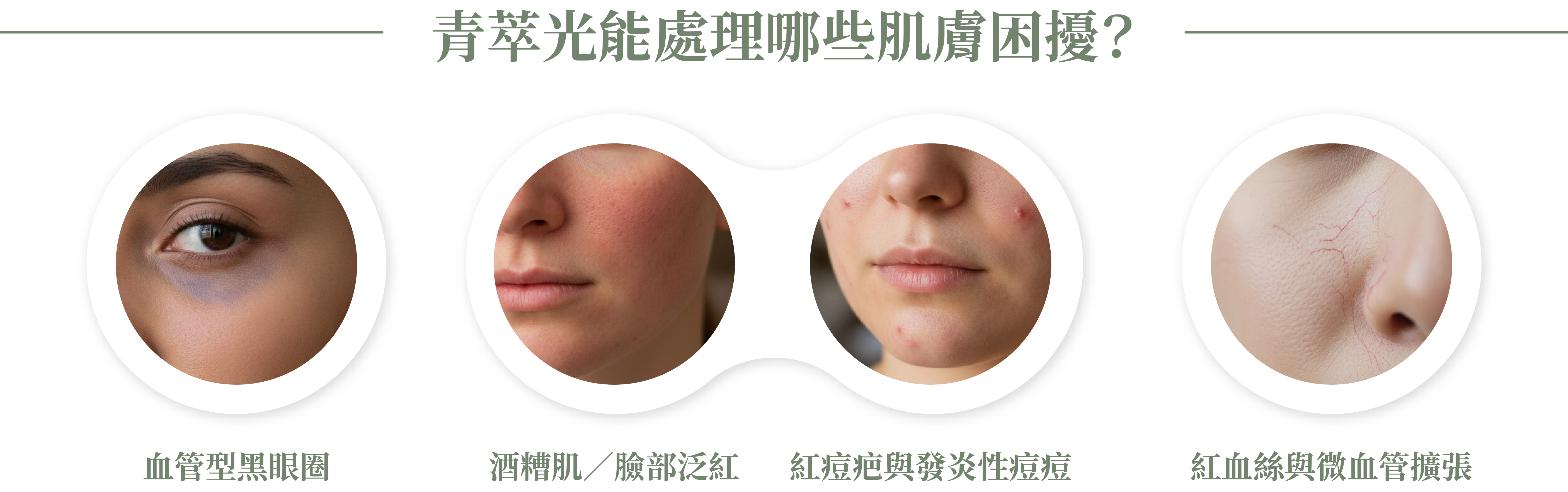 DermaV 青萃光可以改善的肌膚困擾＿辰美學