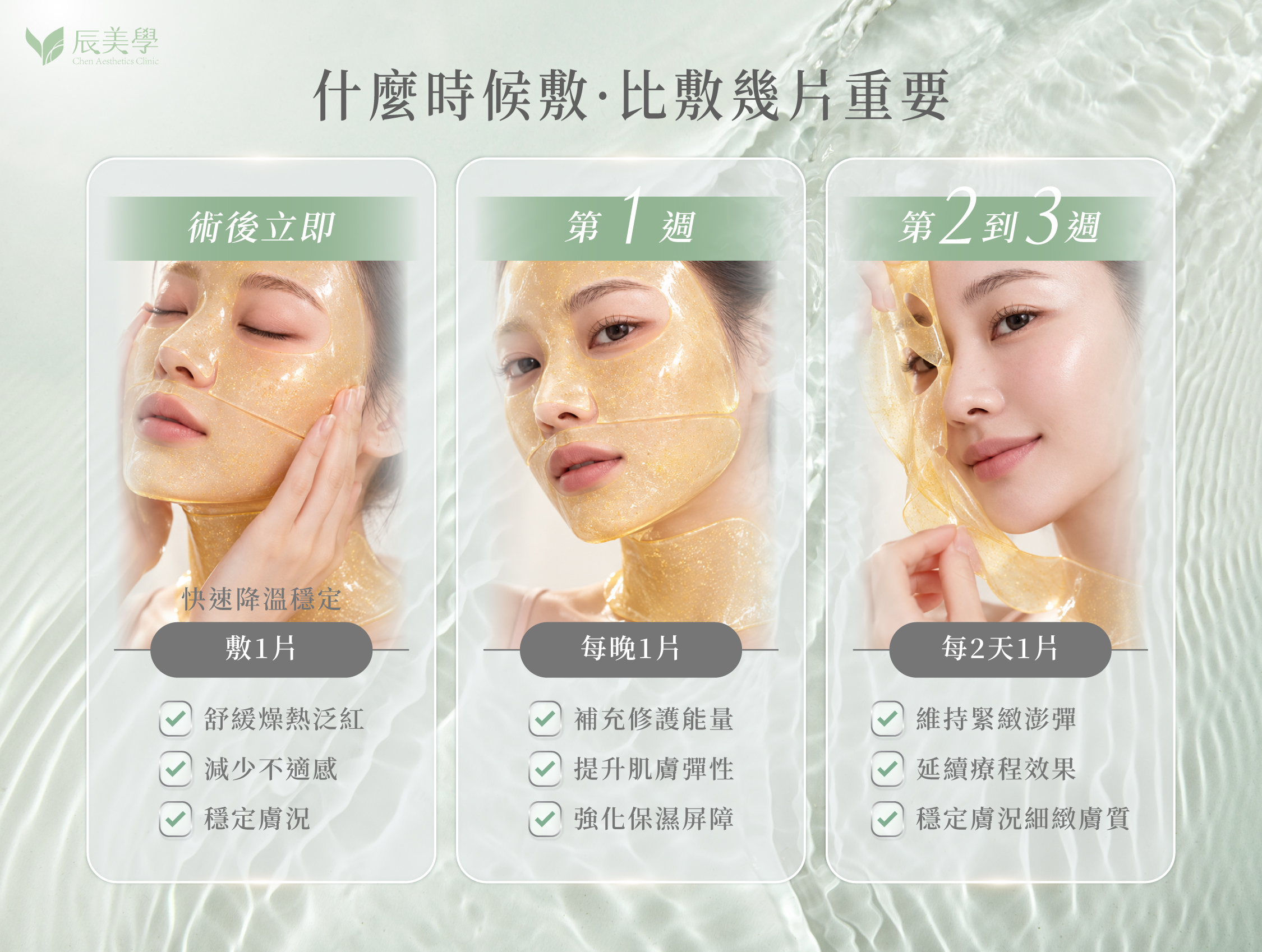 美國音波拉提凍膜建議使用週期時程圖＿辰美學