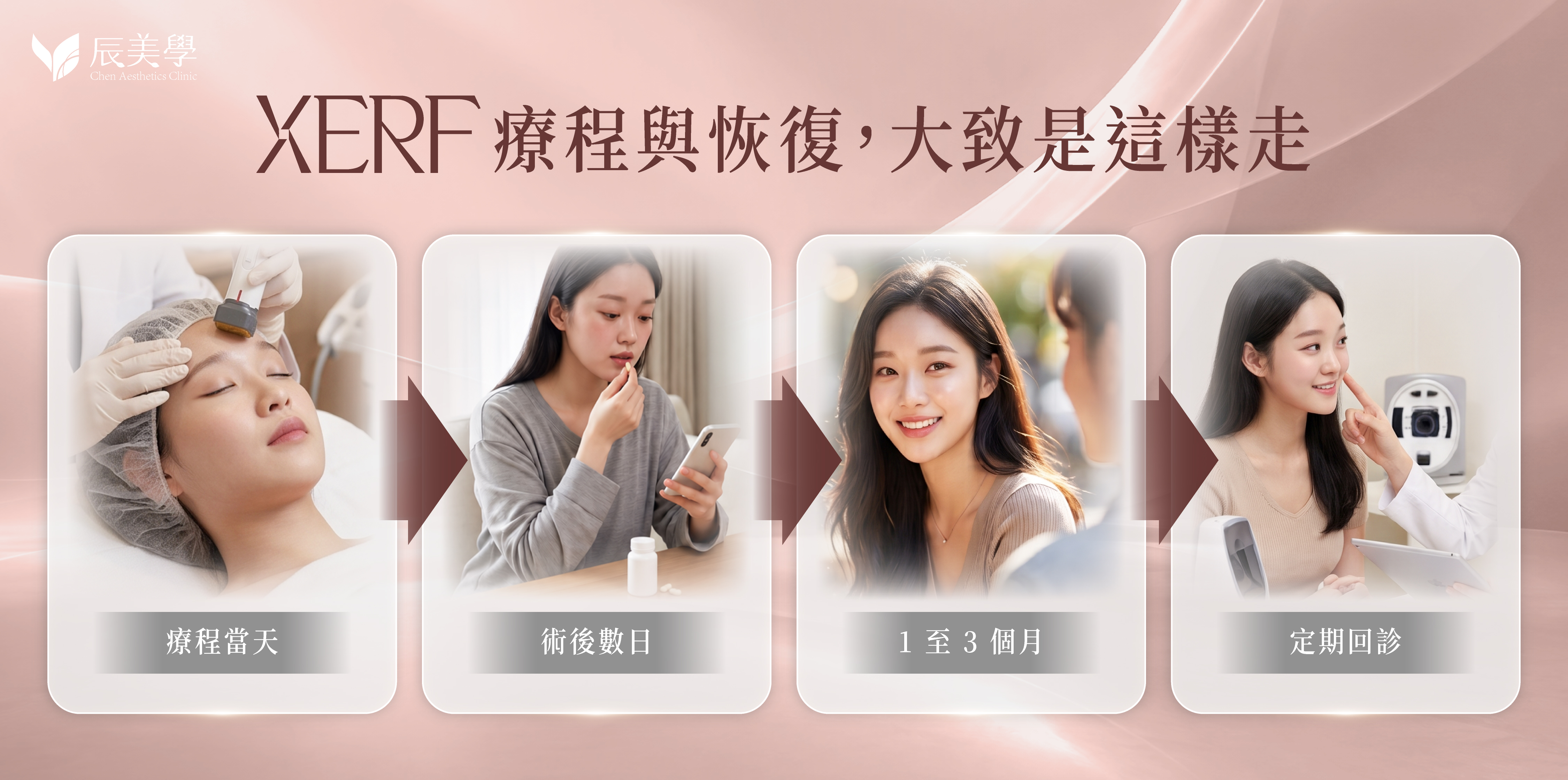 XERF 電波療程流程與恢復時間軸示意圖＿辰美學