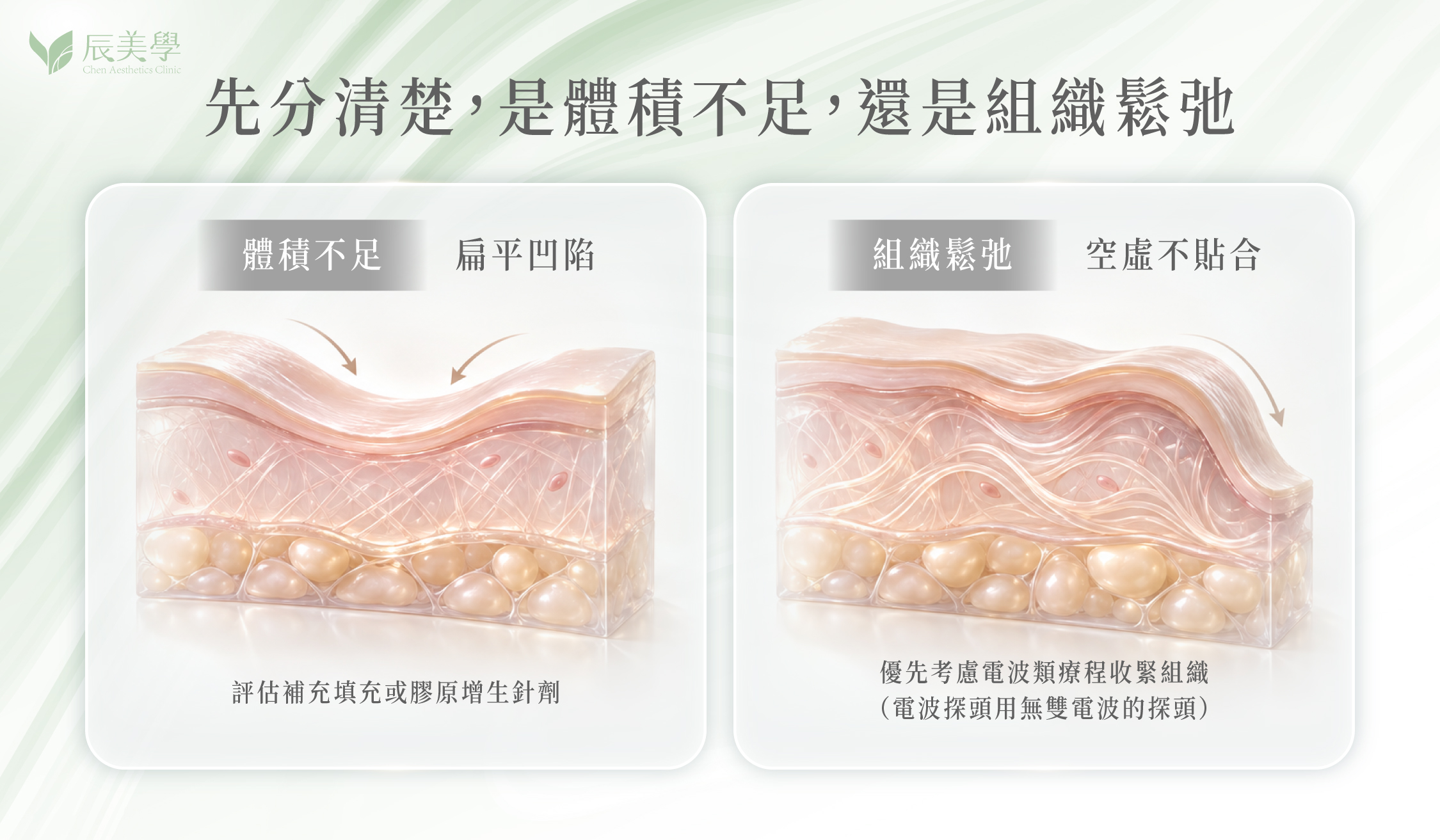 體積不足與組織鬆弛判斷與治療方向比較圖＿辰美學