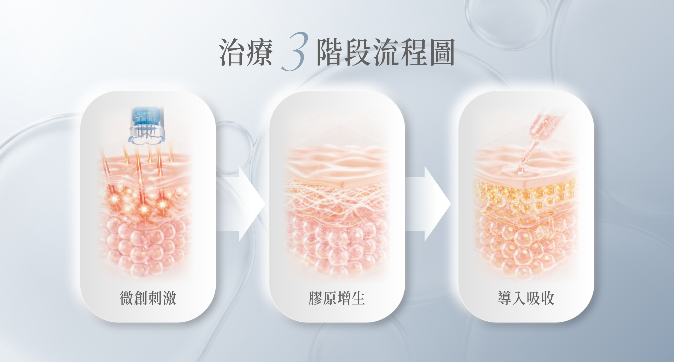 治療 3 階段流程圖：微創刺激 → 膠原增生 → 導入吸收