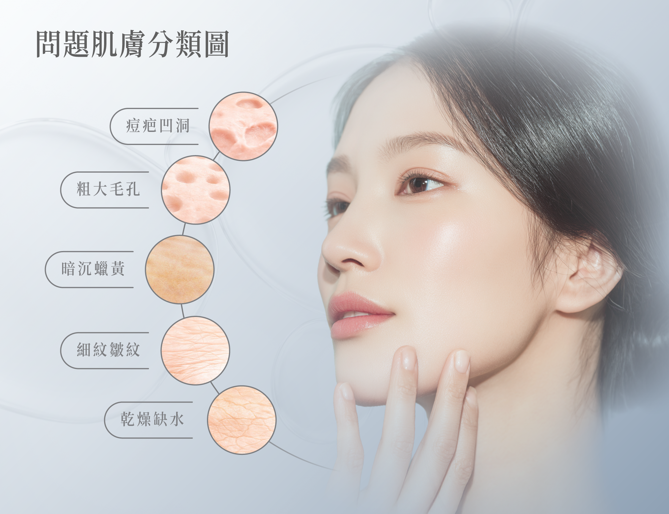問題肌膚分類圖：痘疤凹洞、粗大毛孔、暗沉蠟黃、細紋皺紋、乾燥缺水