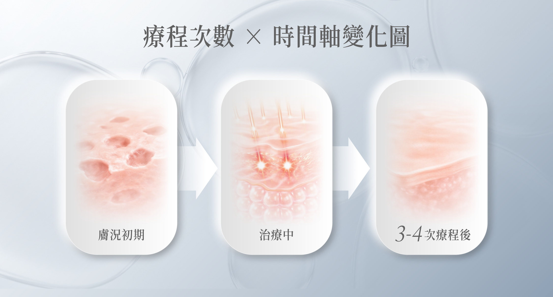 療程次數 × 時間軸變化圖:膚況初期 → 治療中 → 3–4 次療程後