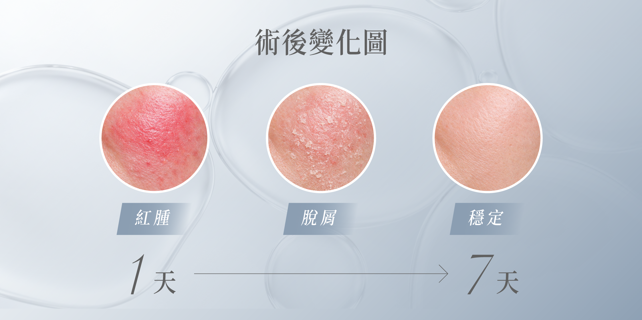 得美微針筆術後變化圖：紅腫 → 脫屑 → 穩定（約 1 天至 7 天）