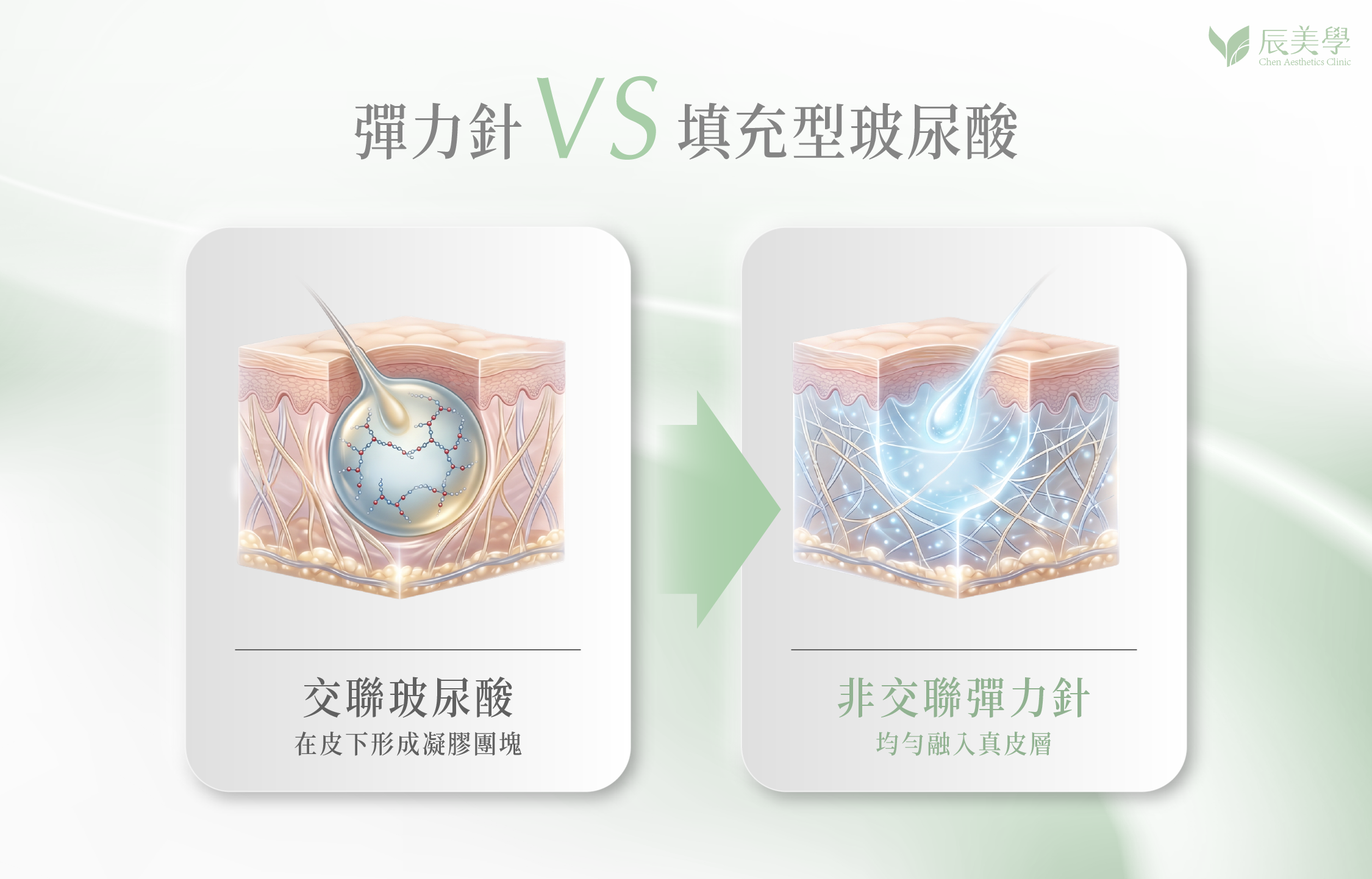 彈力針和玻尿酸的差別＿辰美學