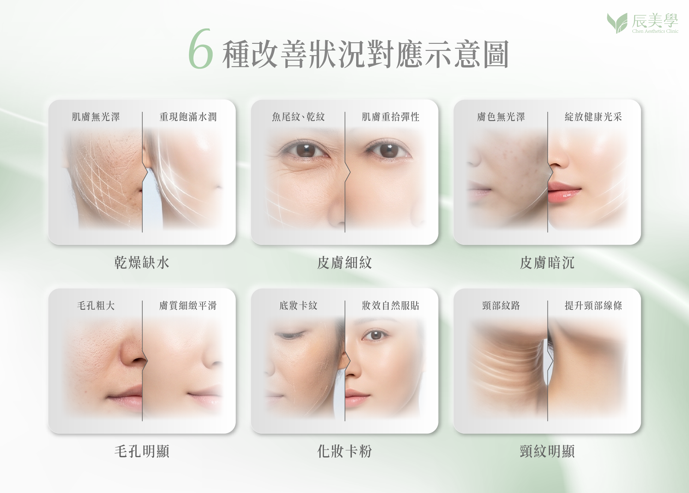 彈力針可以改善的狀況＿辰美學