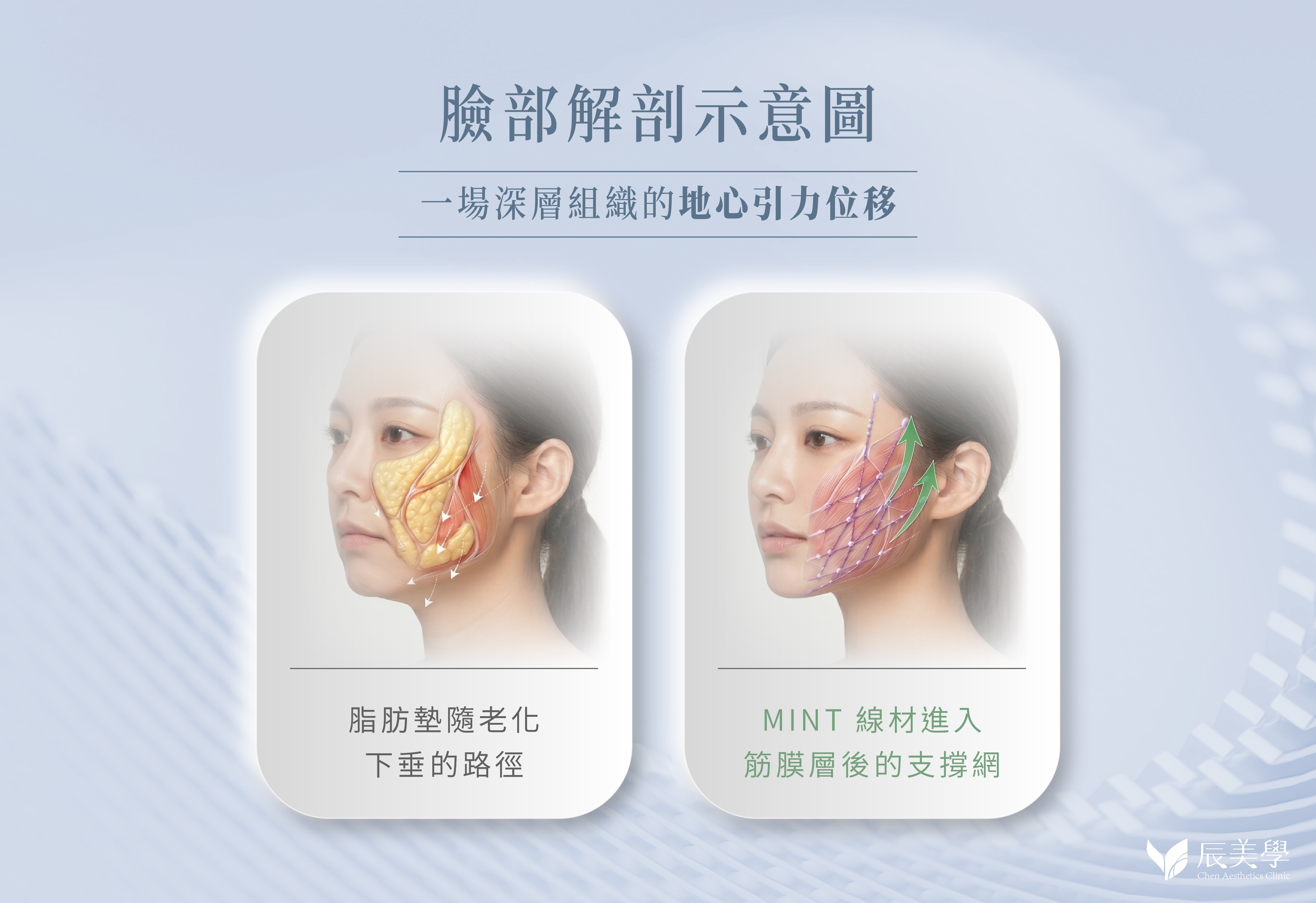 秘線拉提＿辰美學
