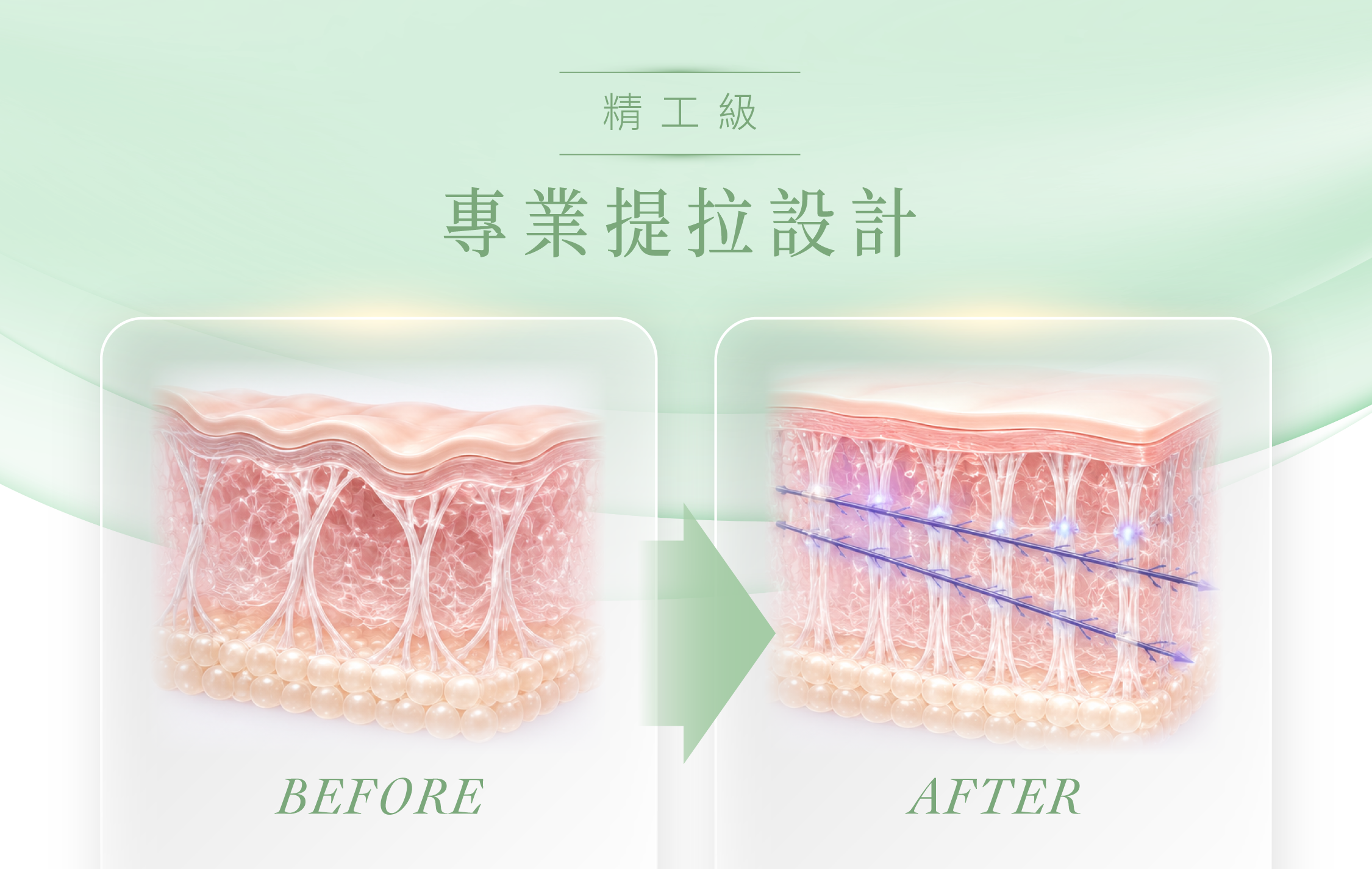 藍鑽魚骨線＿辰美學