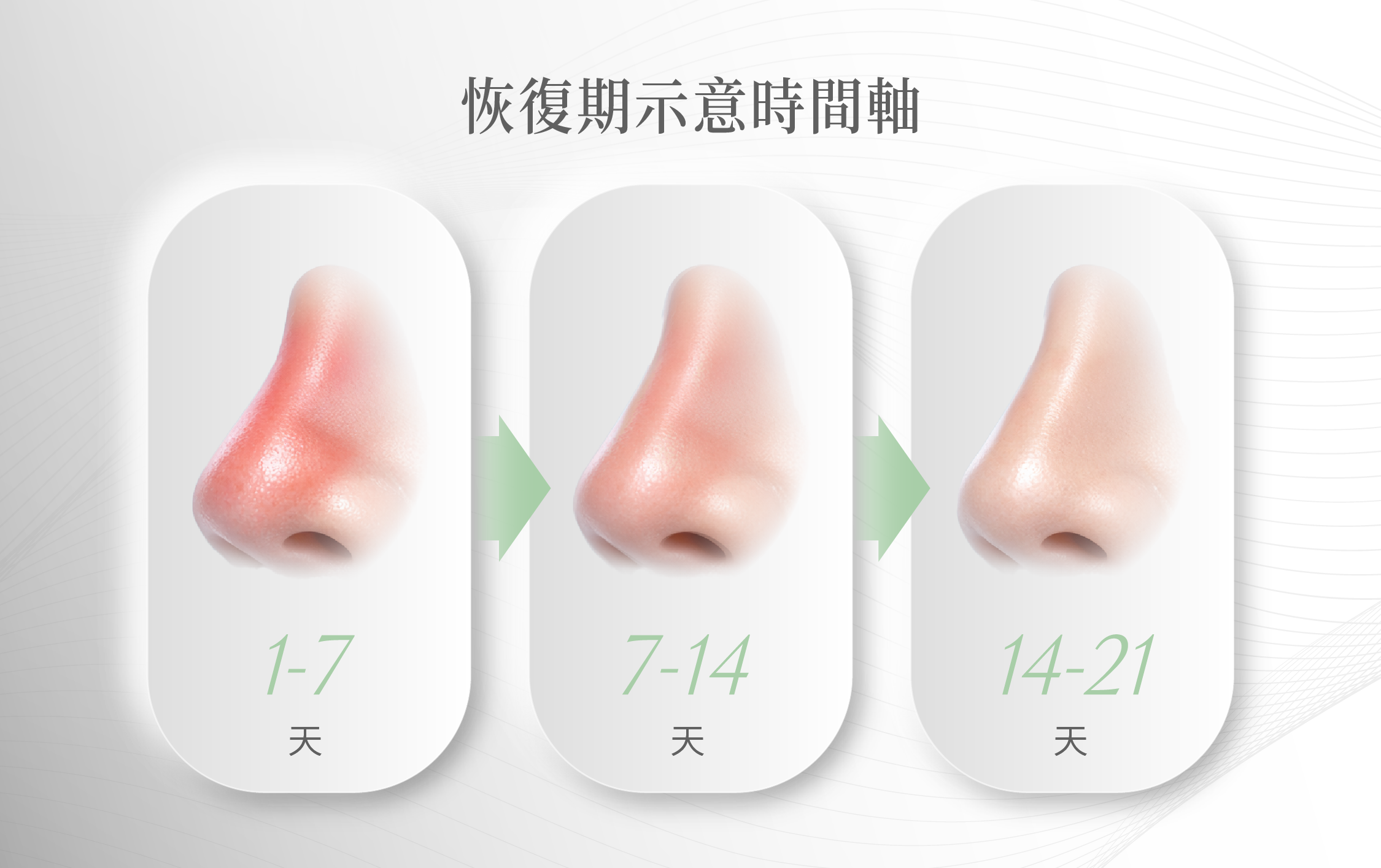 藍鑽魚骨線鼻線恢復期＿辰美學