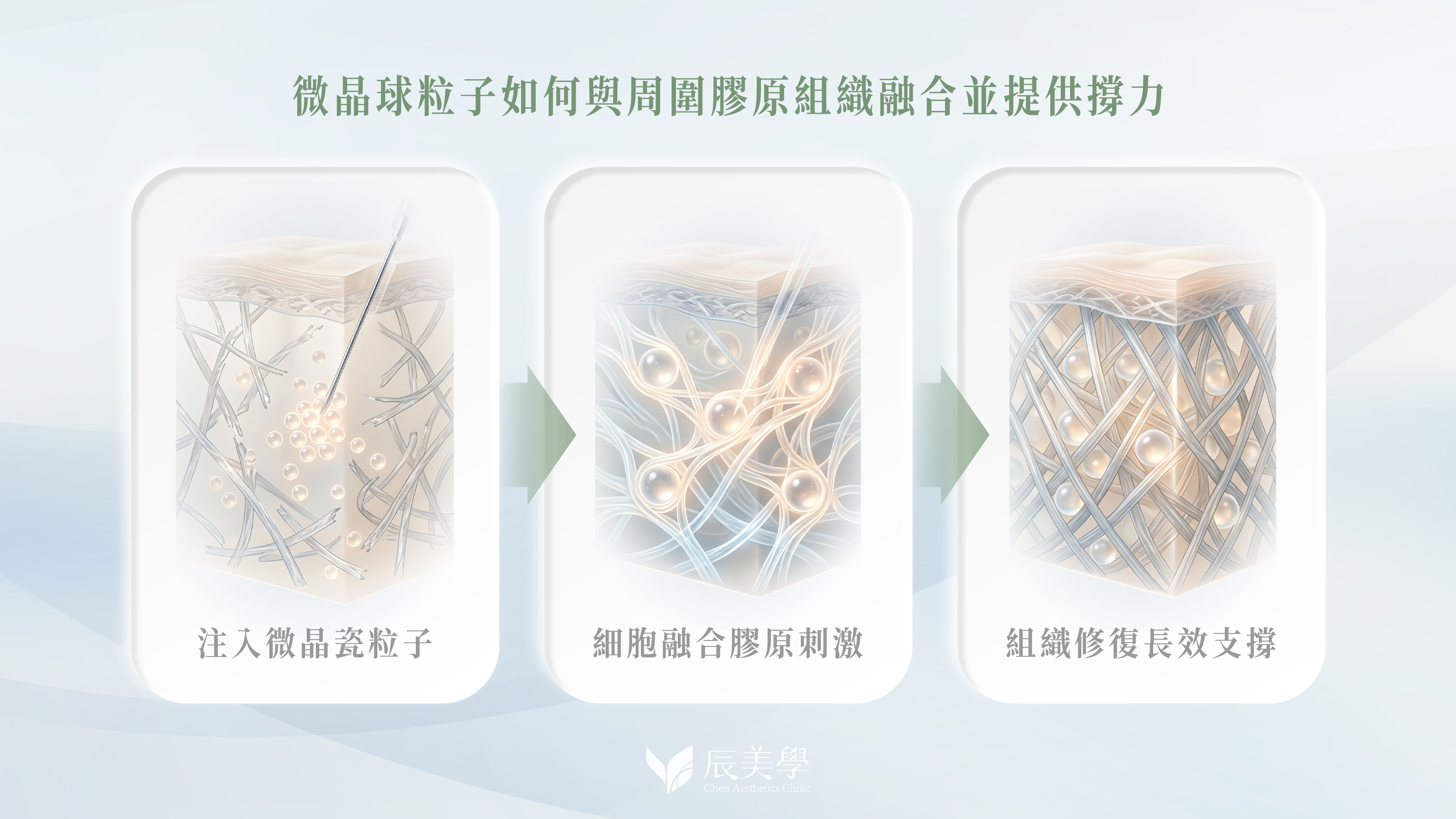 晶亮瓷再生針＿辰美學