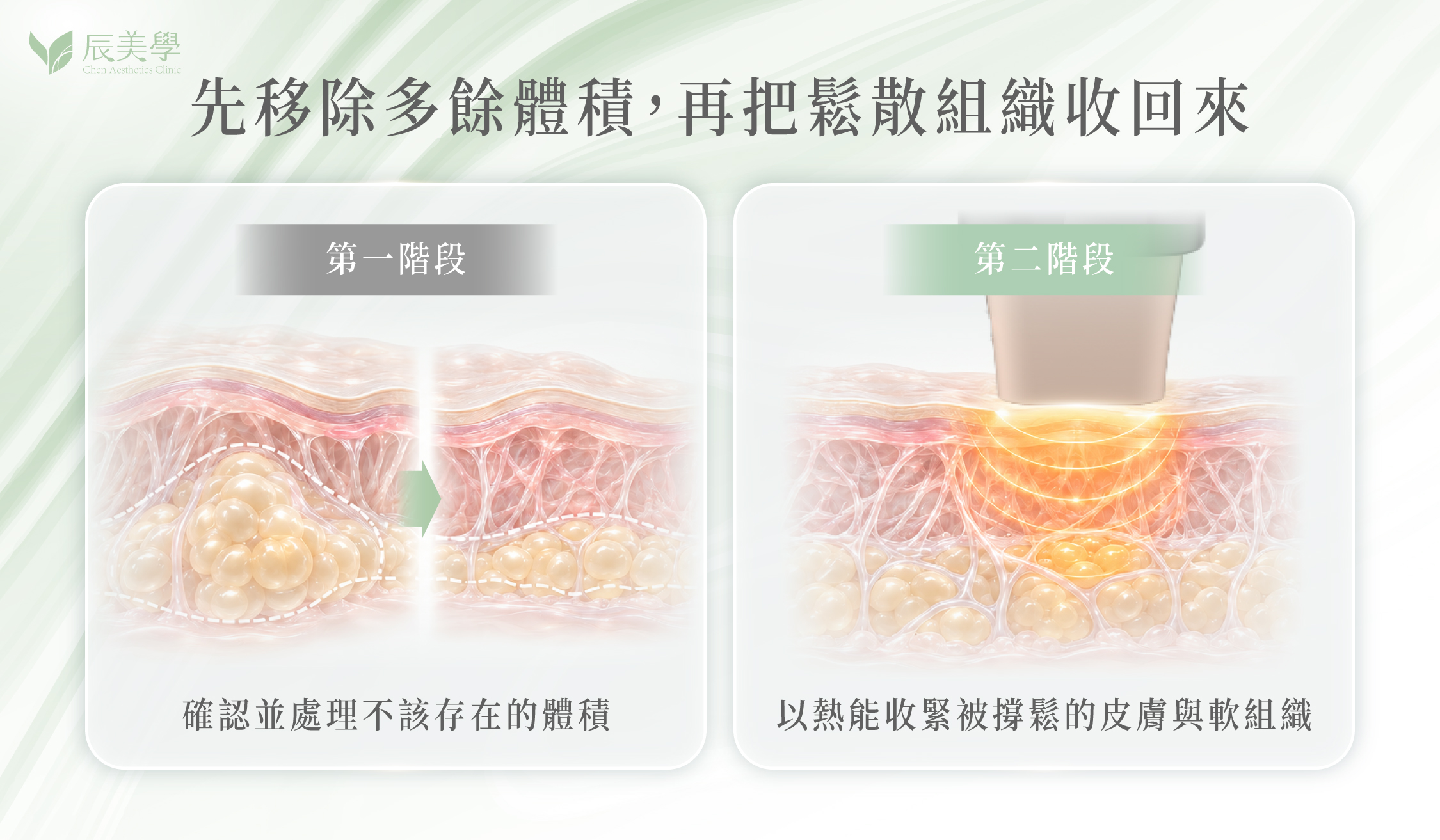 無雙電波作用層次與組織收緊原理示意圖＿辰美學