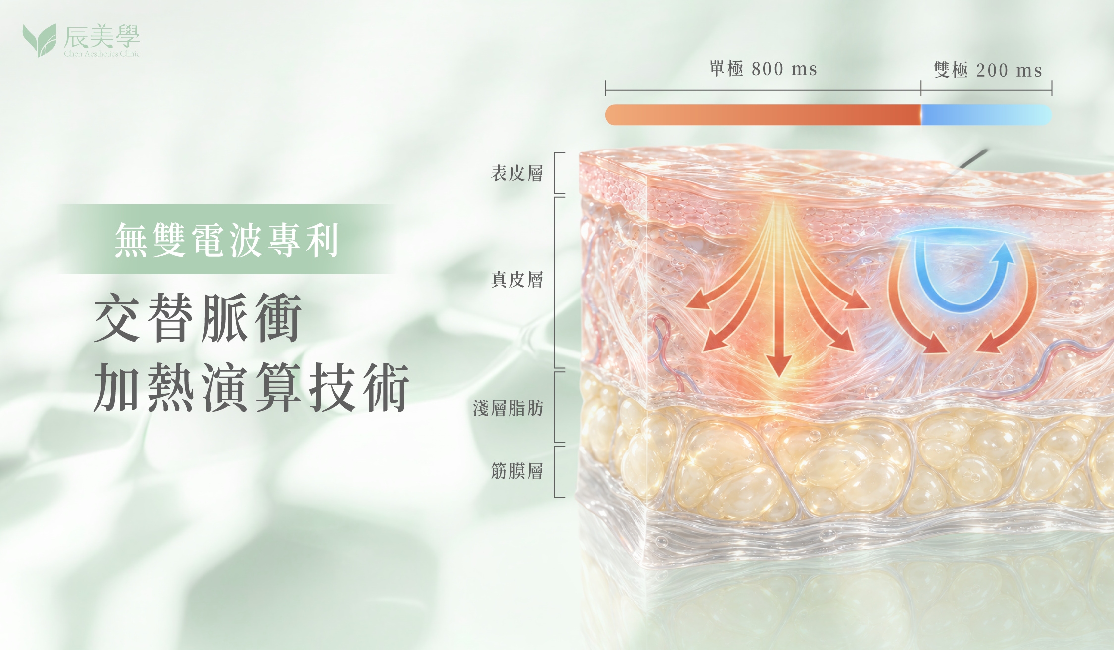 無雙電波與全層定靶式拉提＿辰美學