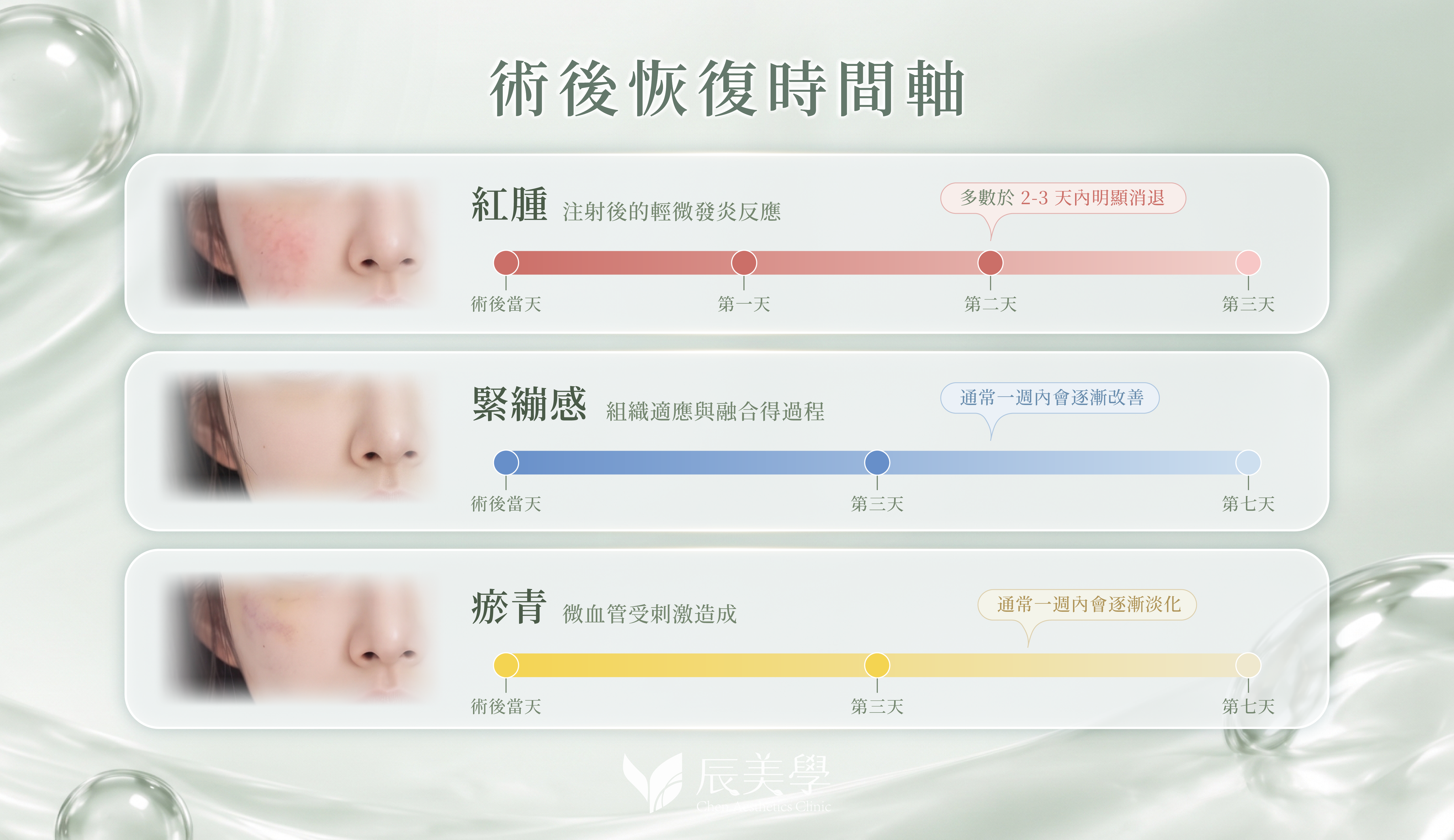 v50玻尿酸術後恢復時間軸_辰美學