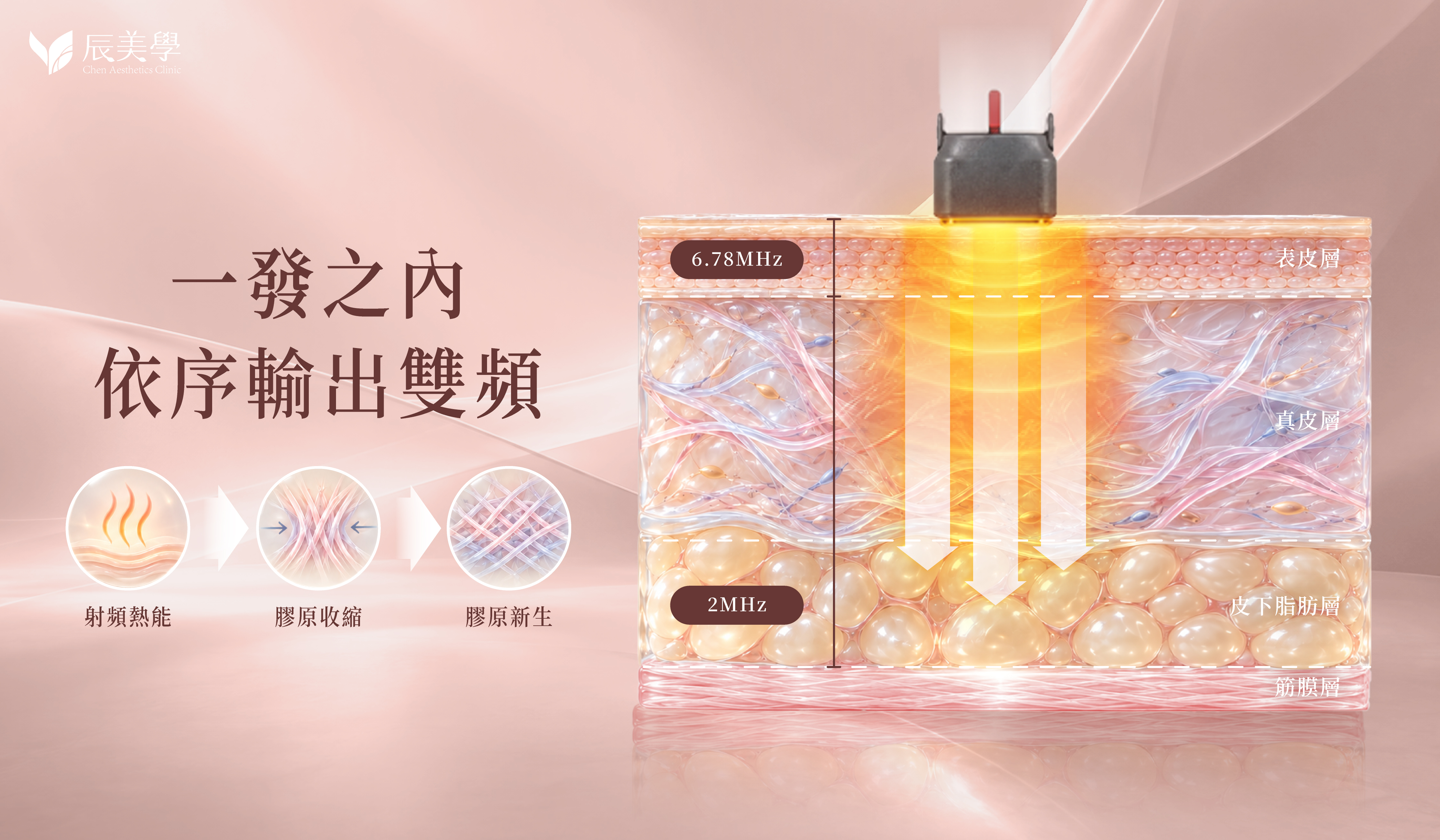 XERF 單發脈衝依序輸出 6.78 MHz 與 2 MHz 雙頻射頻原理示意圖＿辰美學
