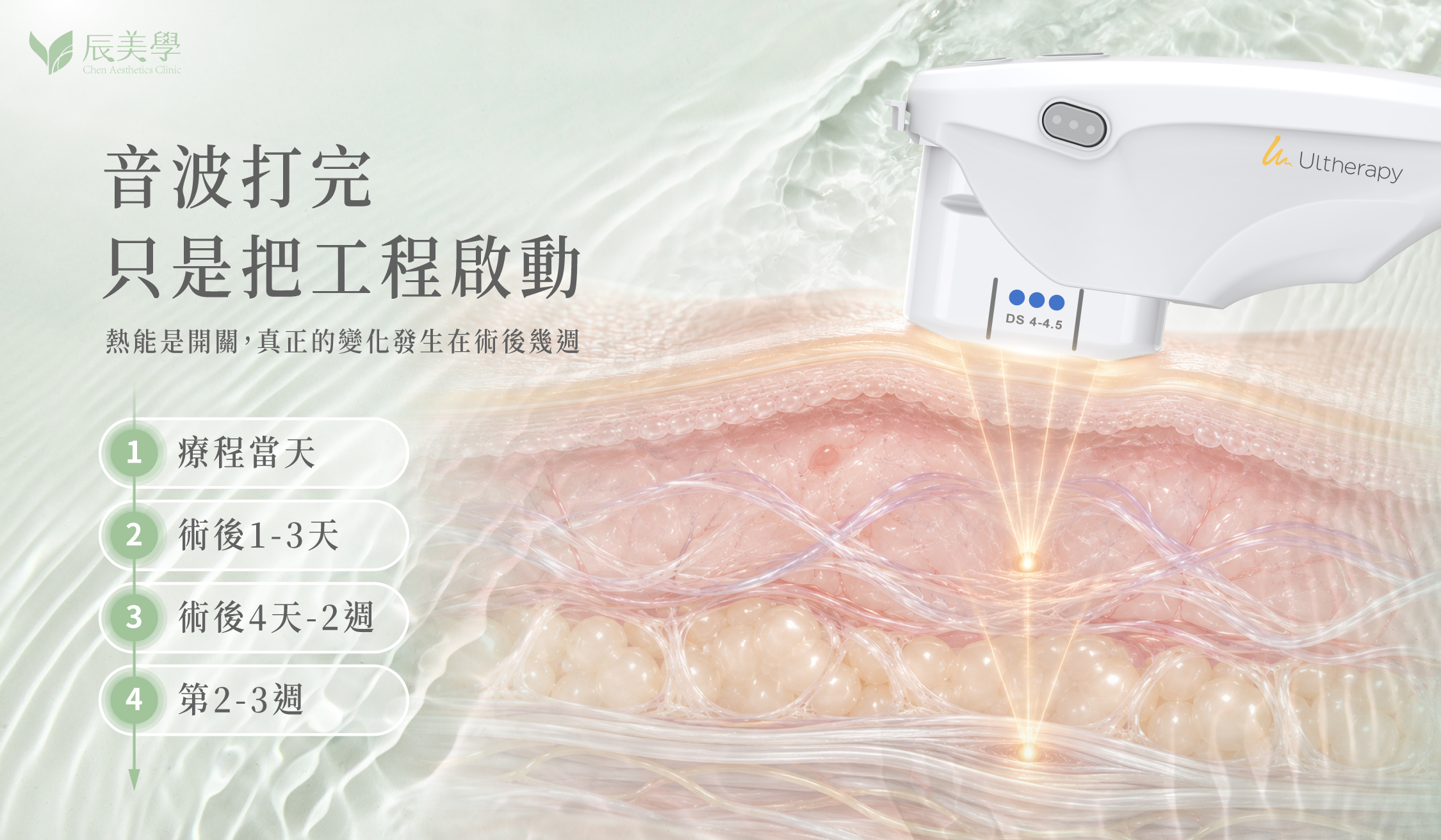 音波術後修復期概念示意圖＿辰美學