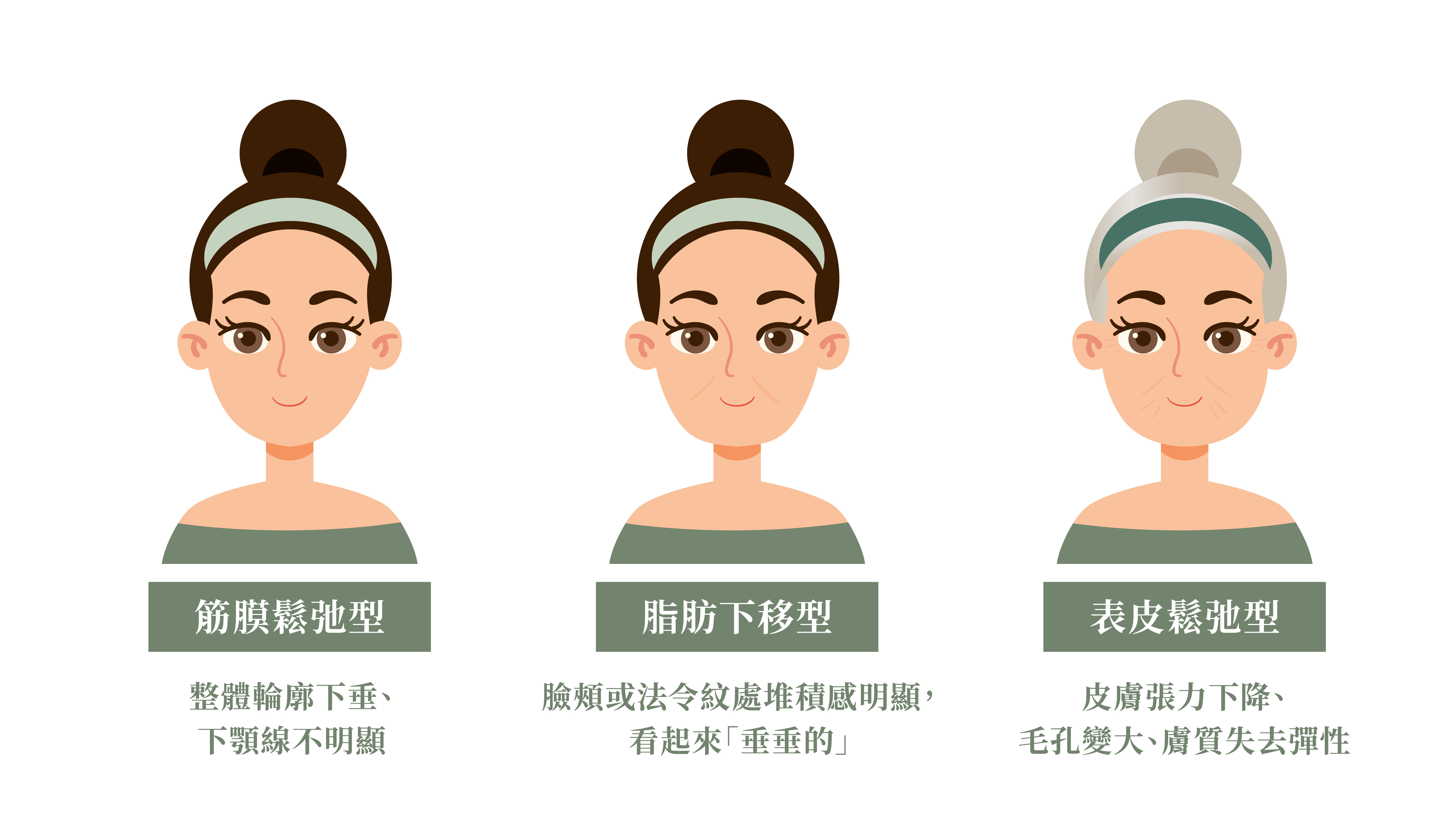 三種鬆弛型態示意圖（筋膜型／脂肪型／表皮型）＿辰美學