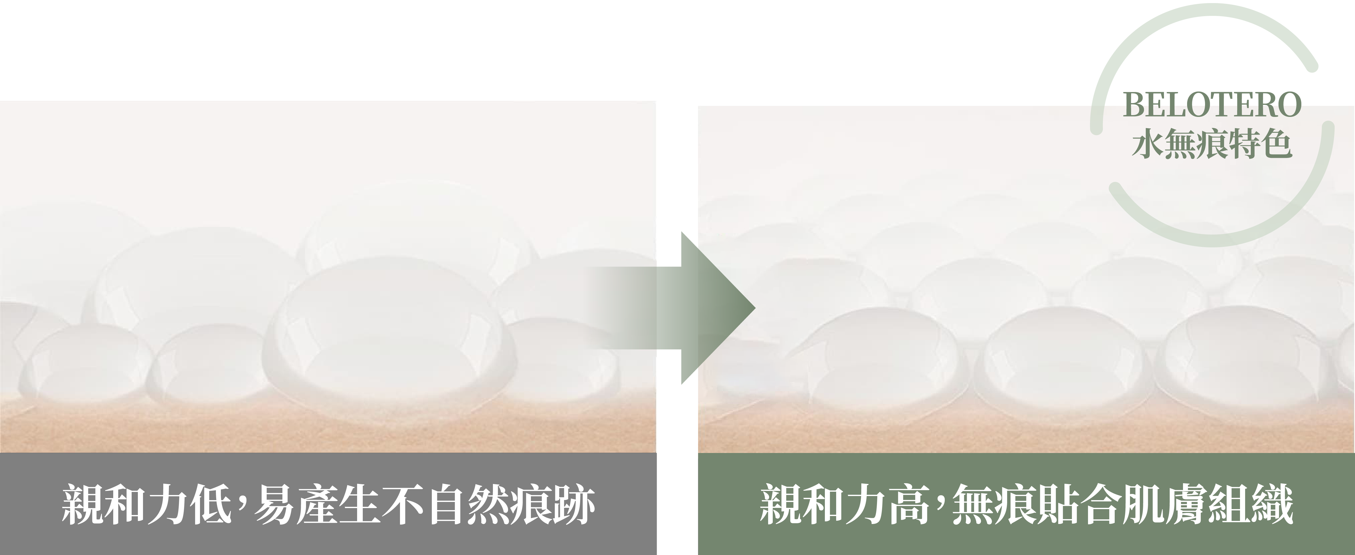 保柔緹玻尿酸_辰美學