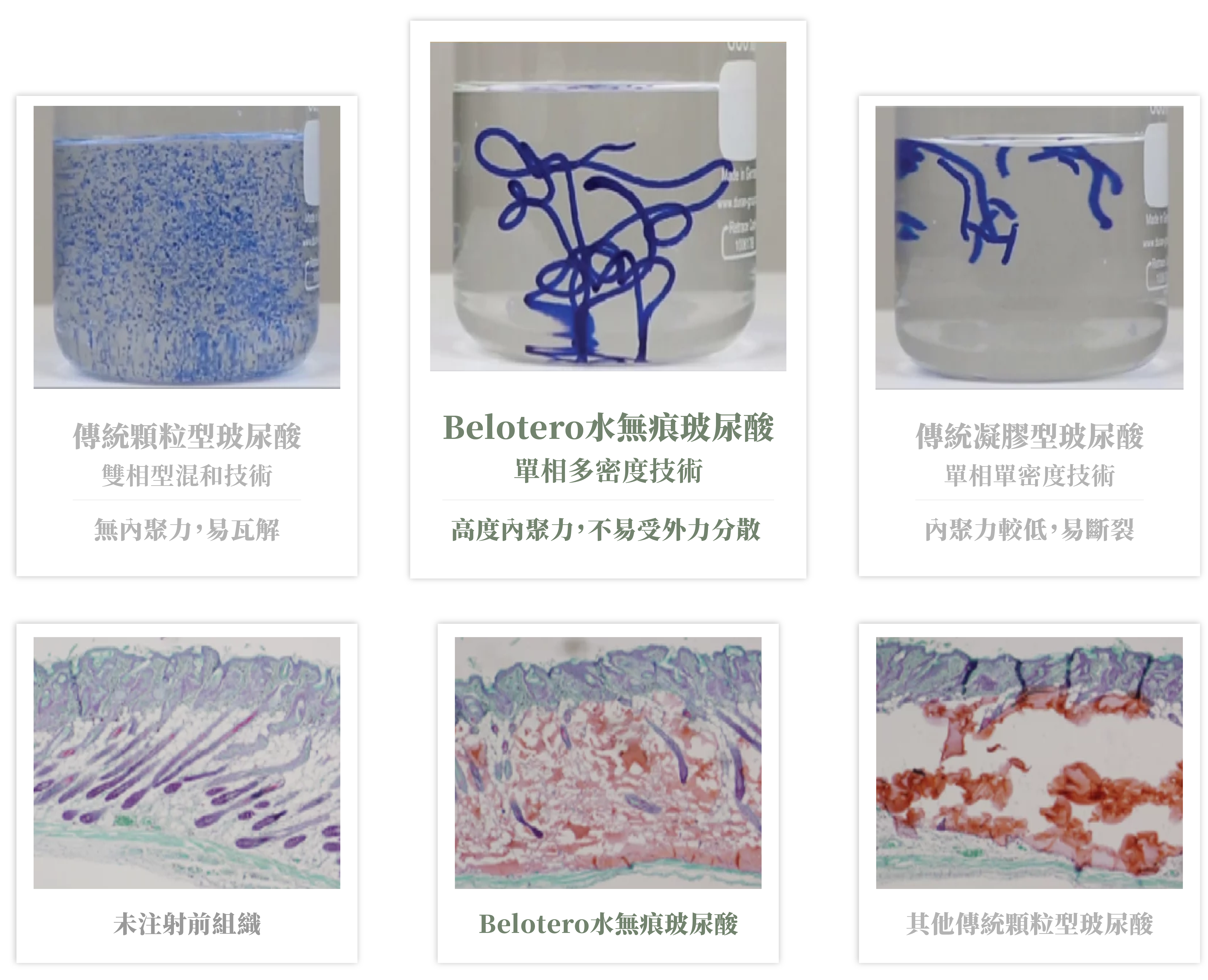 保柔緹玻尿酸_辰美學