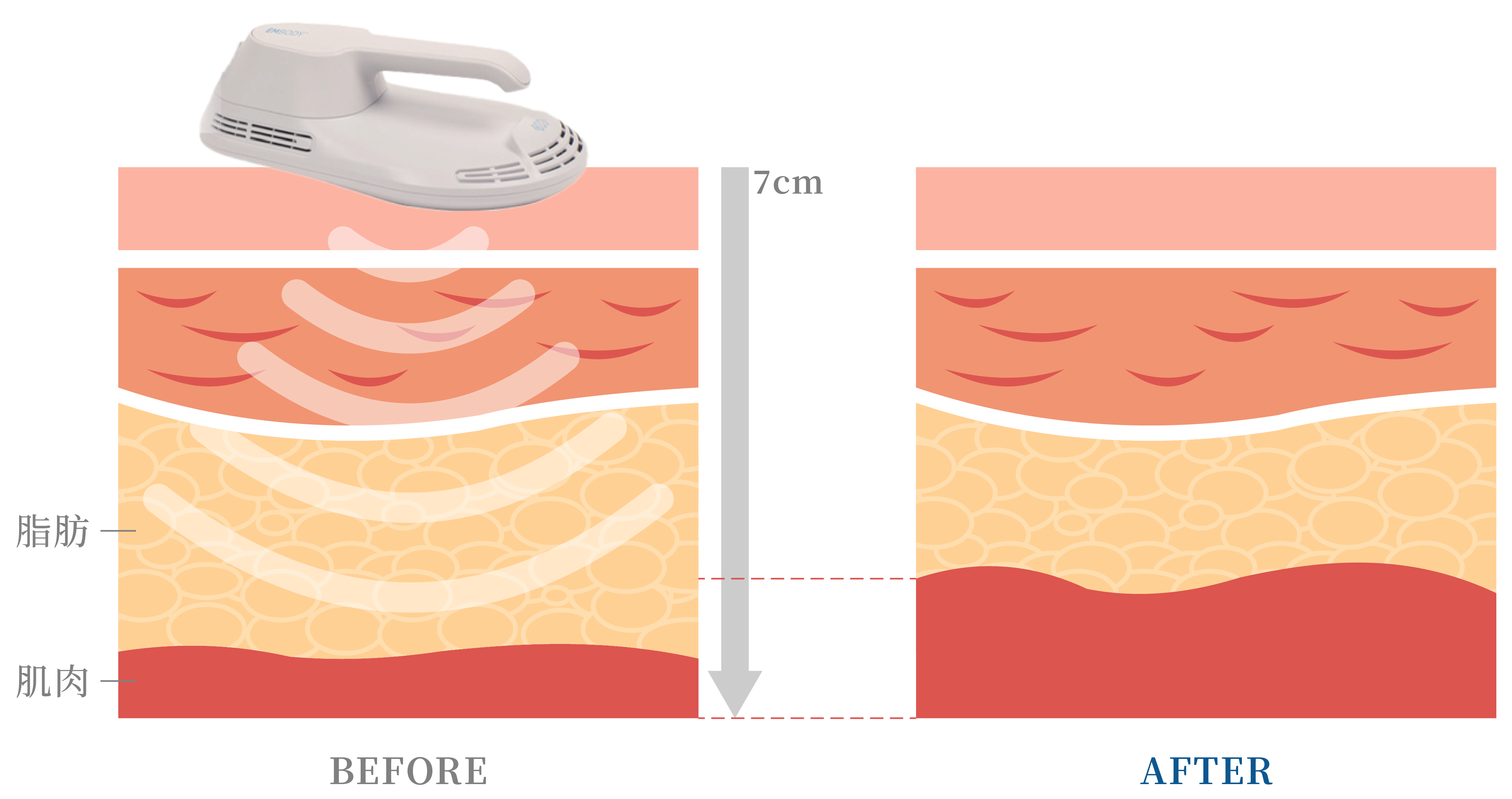 EMBODY 增肌減脂＿辰美學