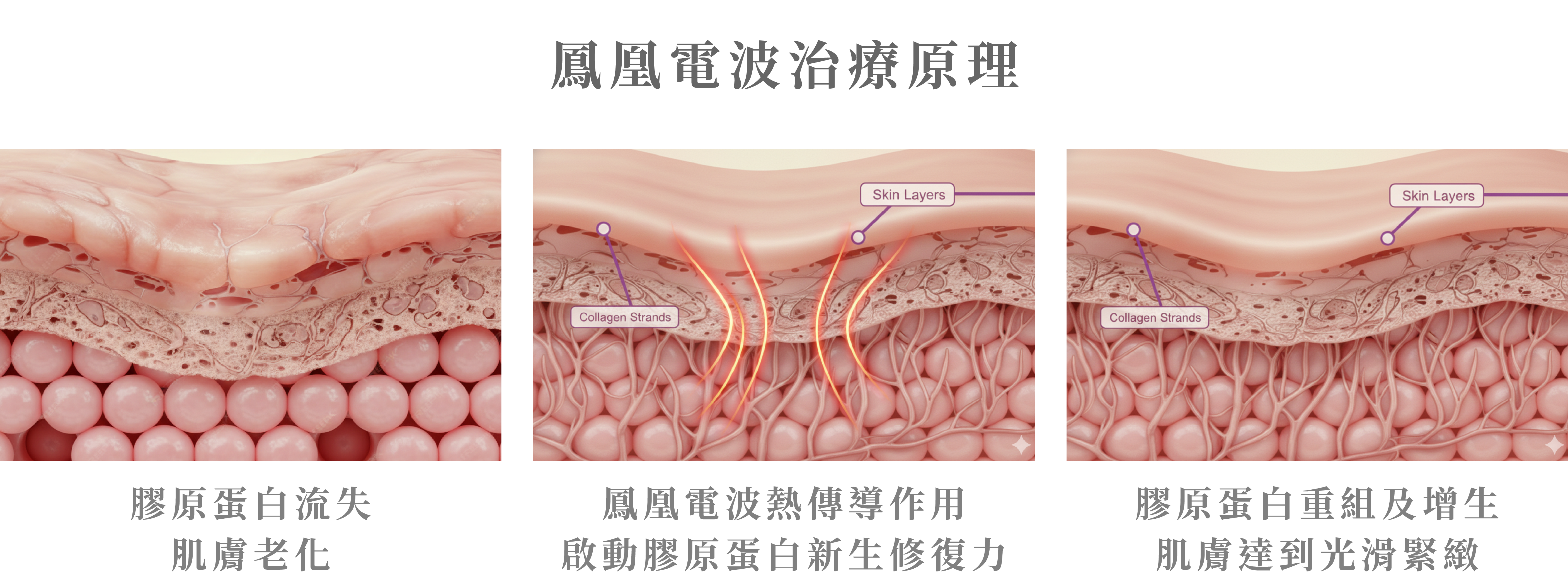 鳳凰電波治療原理＿辰美學