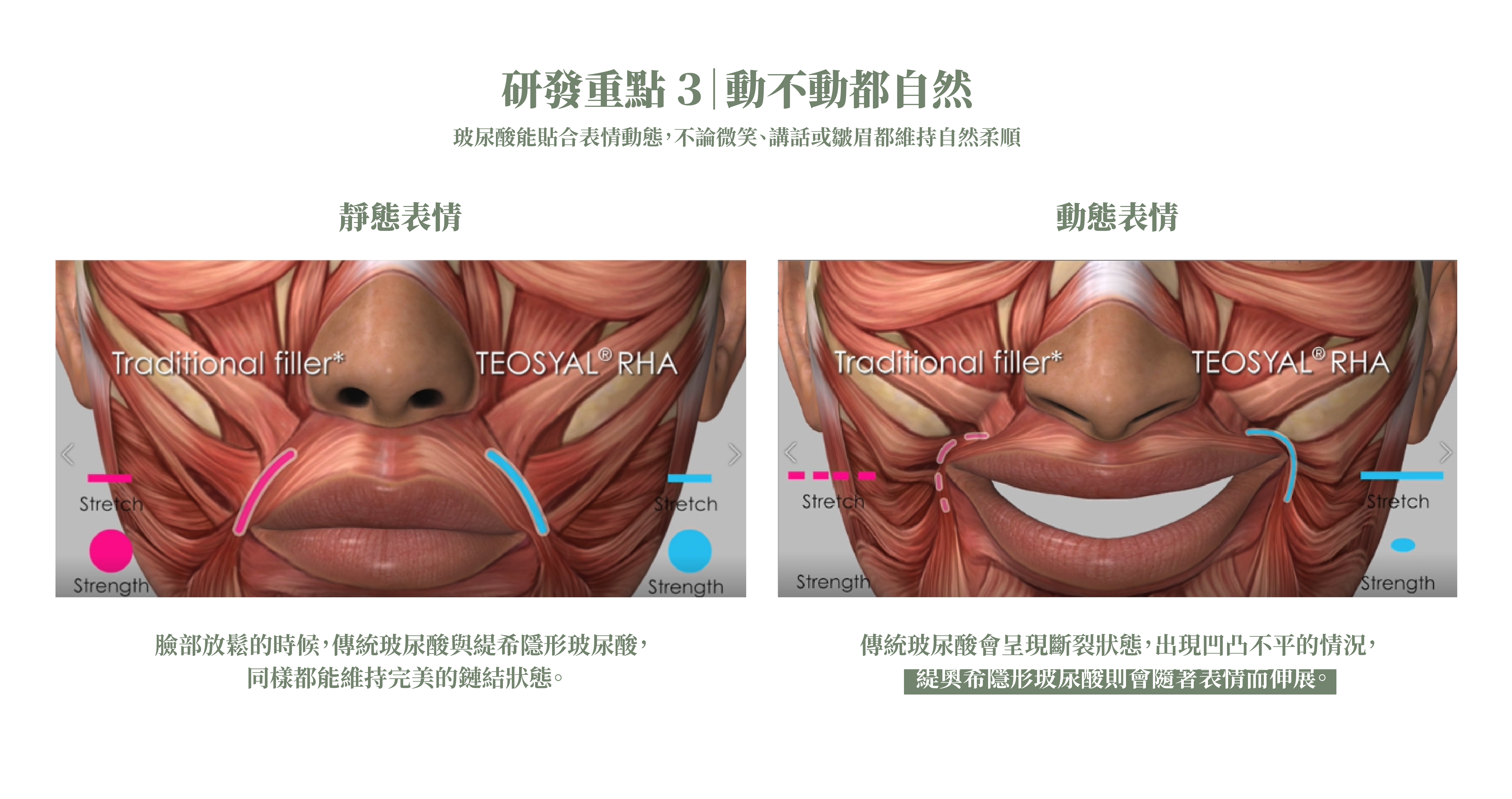 緹奧希玻尿酸_辰美學