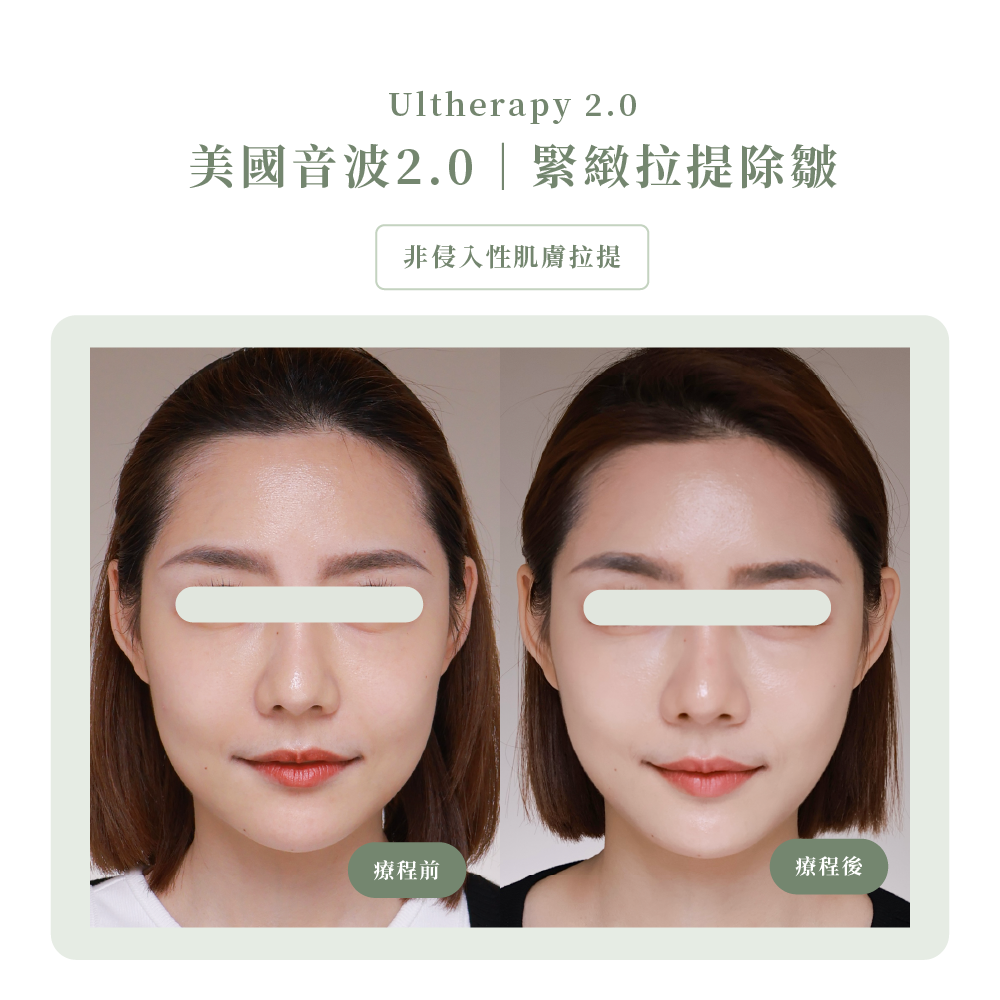 美國音波BA照＿辰美學