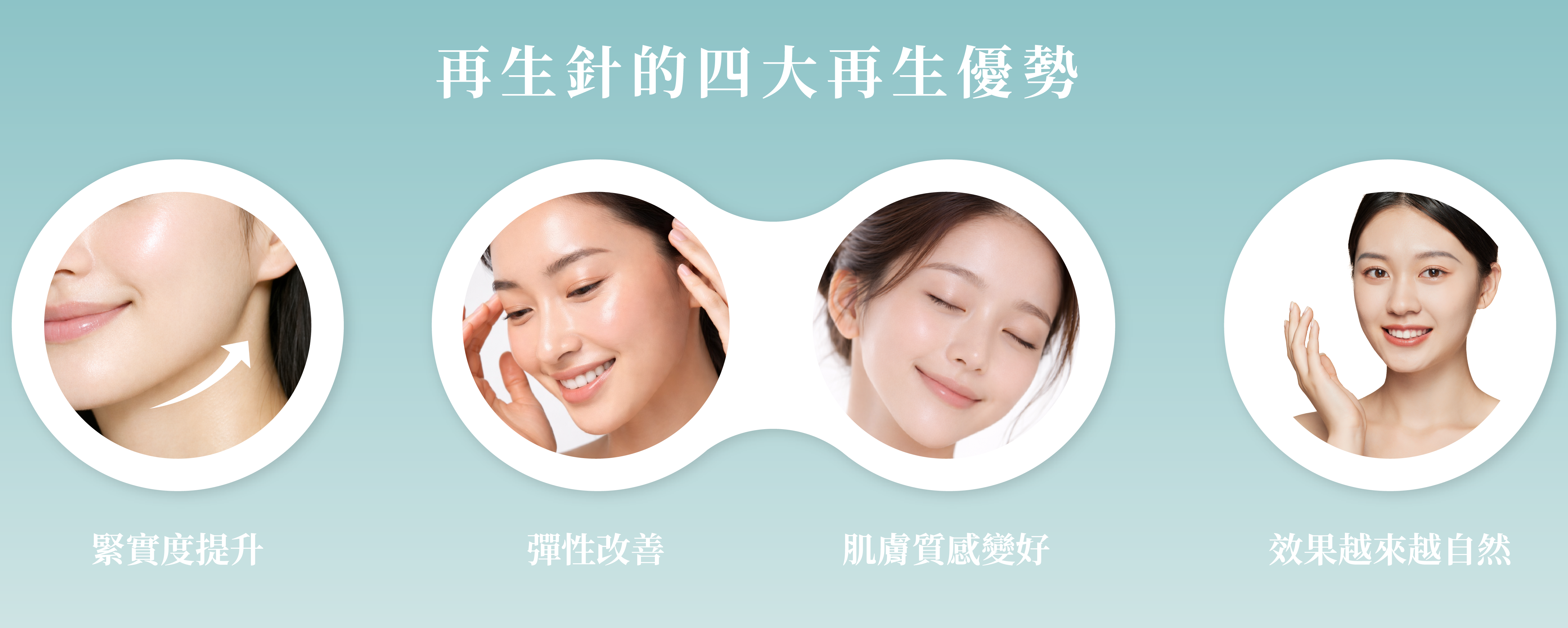 再生針的優勢＿辰美學