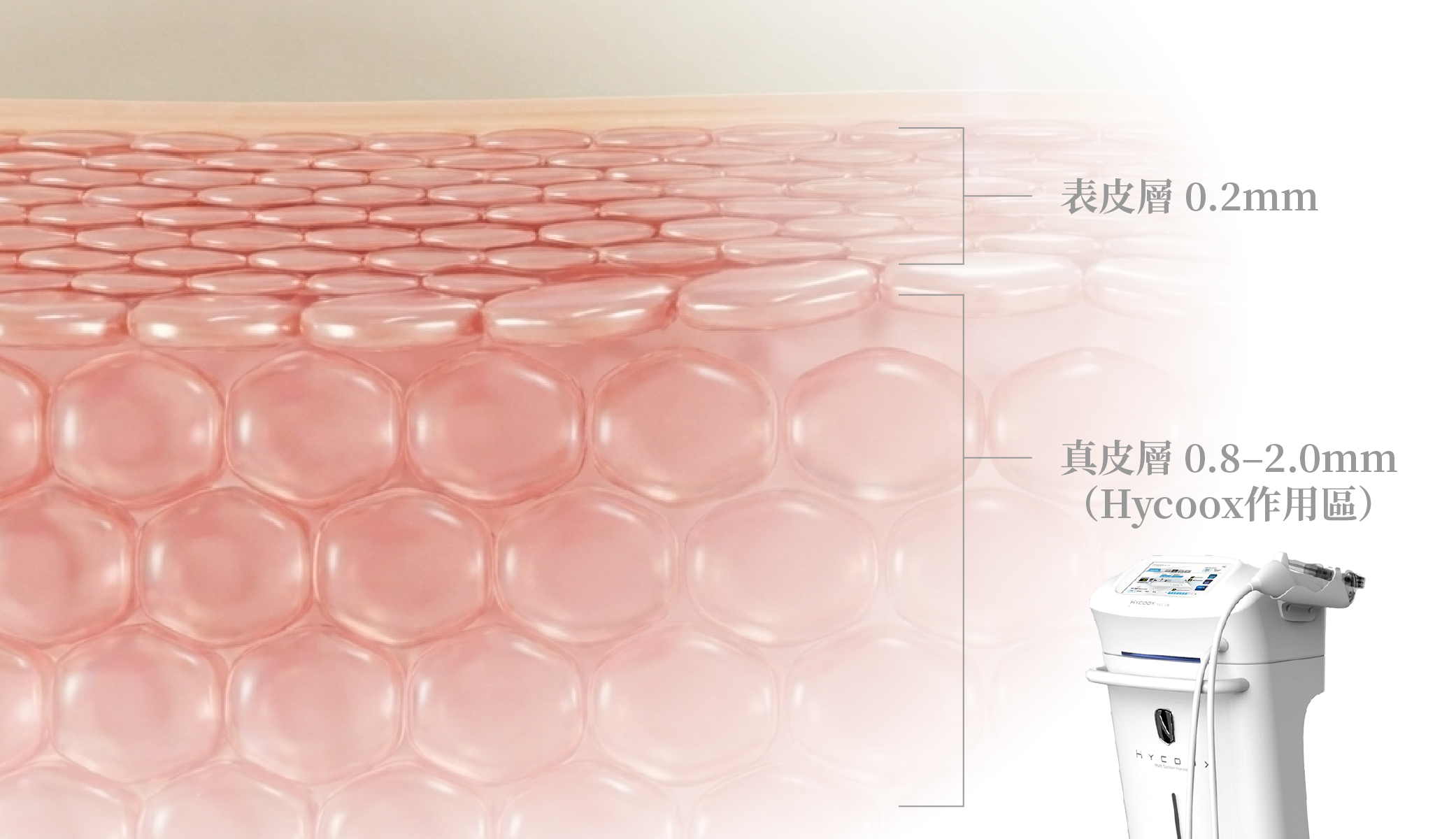 海庫斯水光儀注射層次＿辰美學