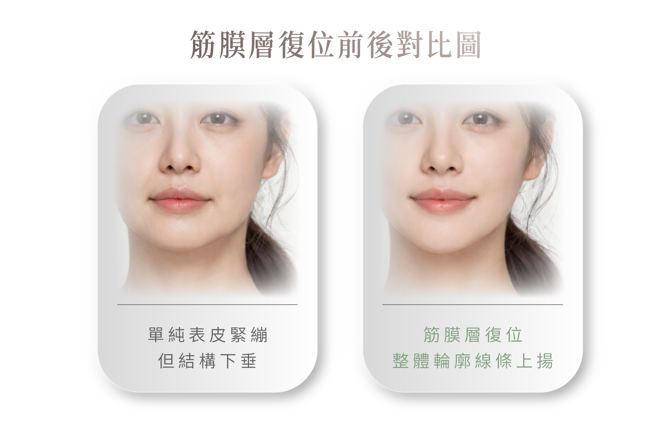 秘線拉提＿辰美學