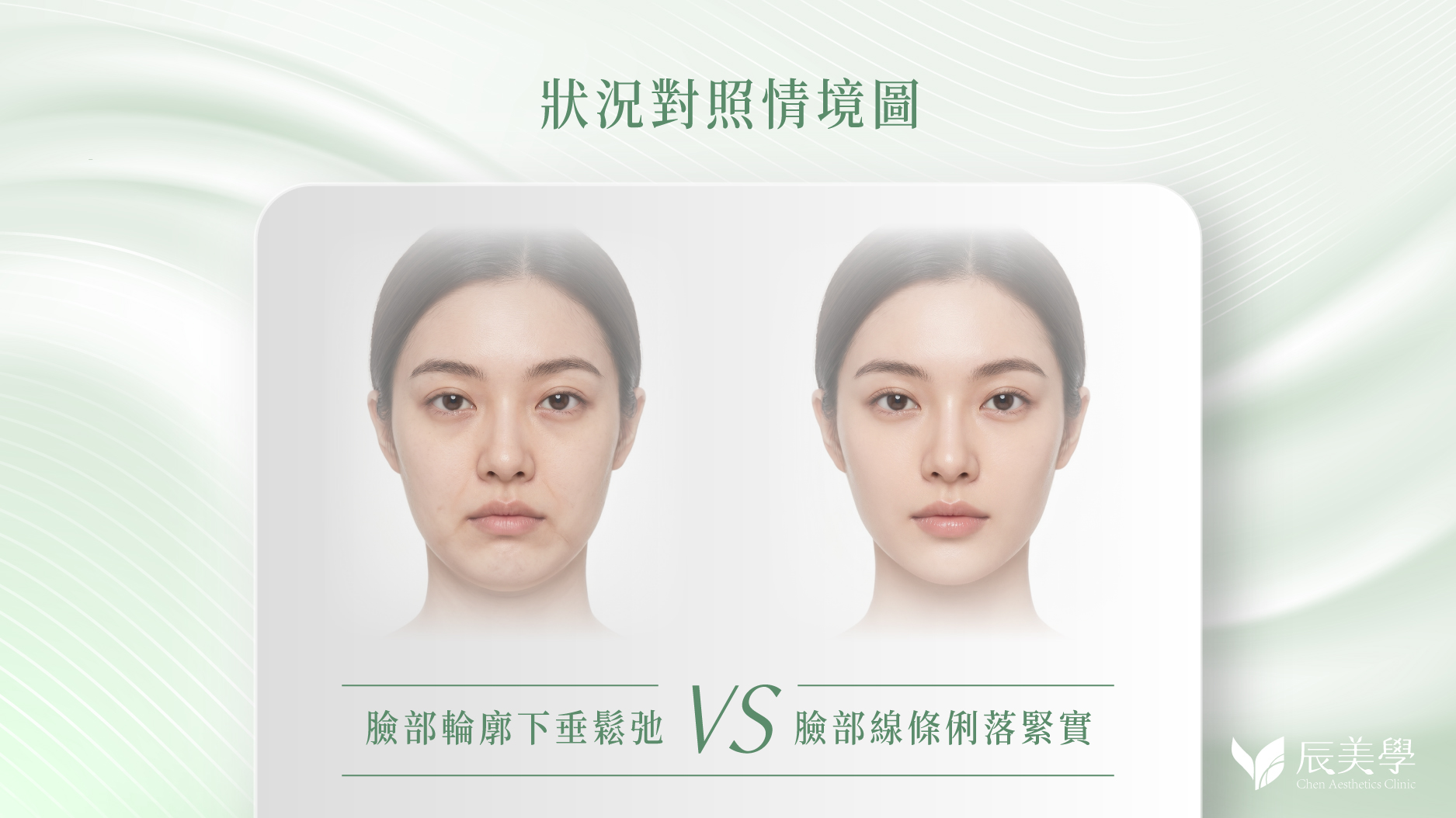 美音二代、海芙音波第三代_辰美學