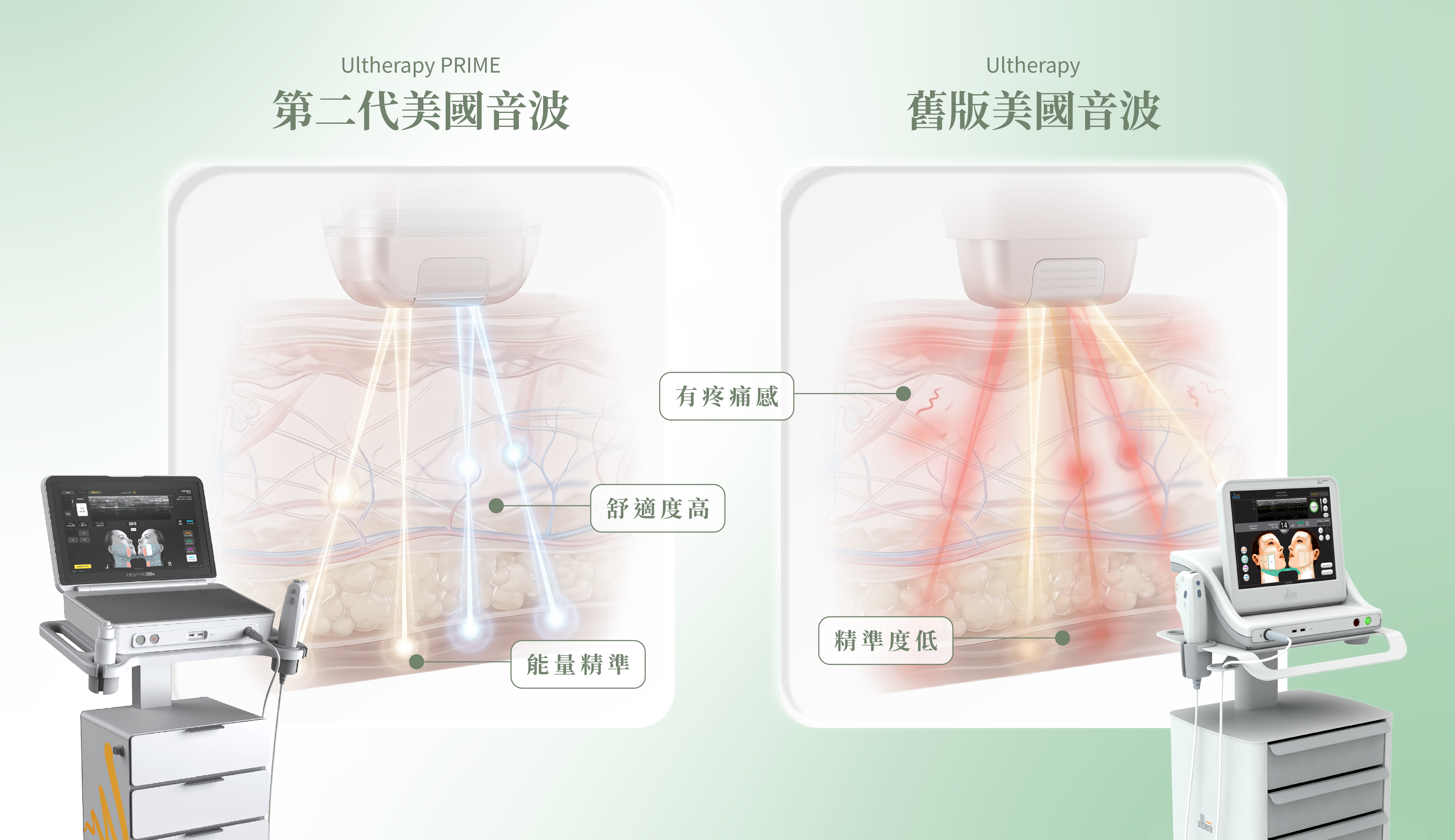 第二代美國音波 Ultherapy PRIME 與舊版美國音波能量精準度、舒適度比較