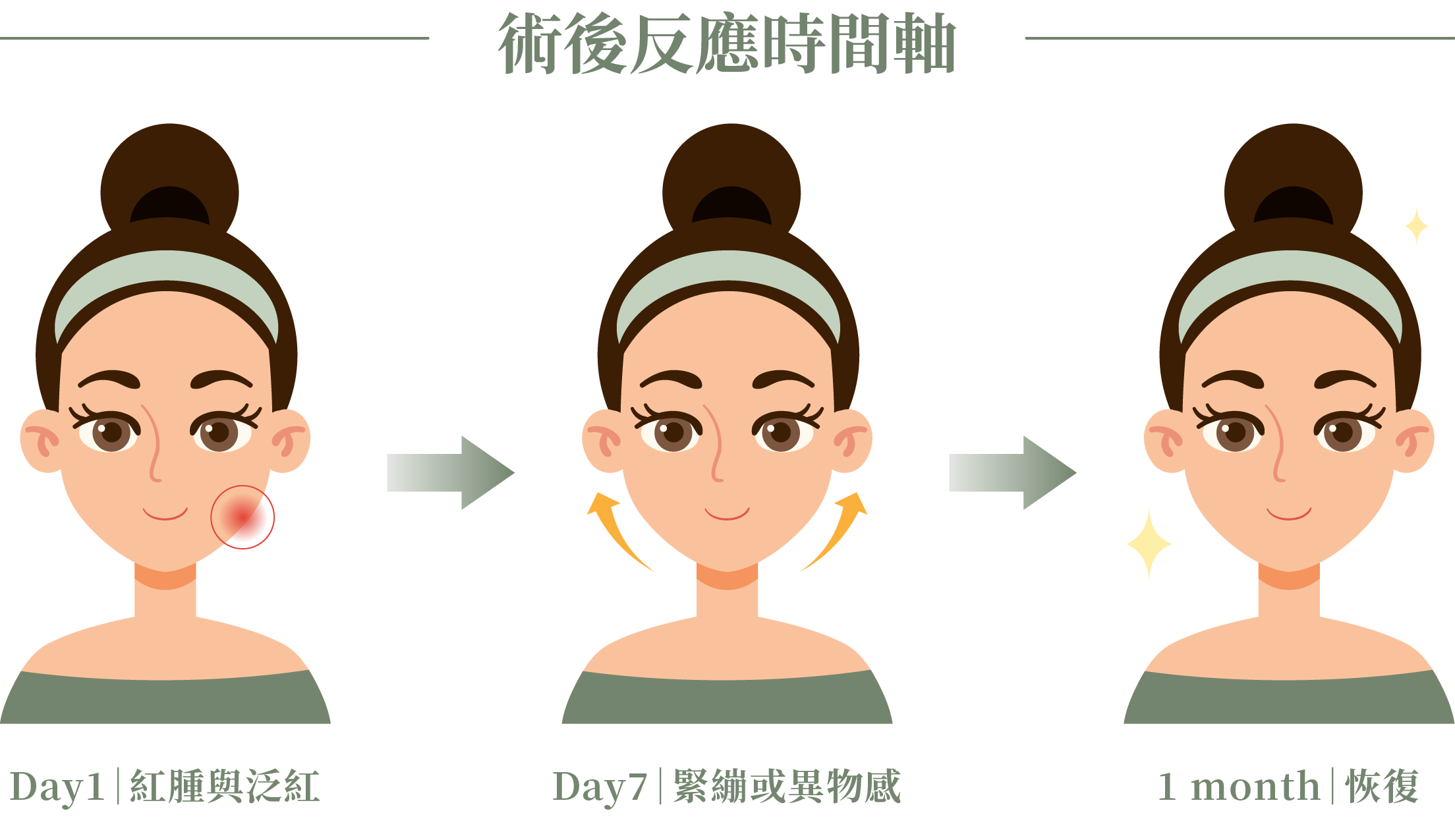 施打完玻尿酸的術後反應_辰美學