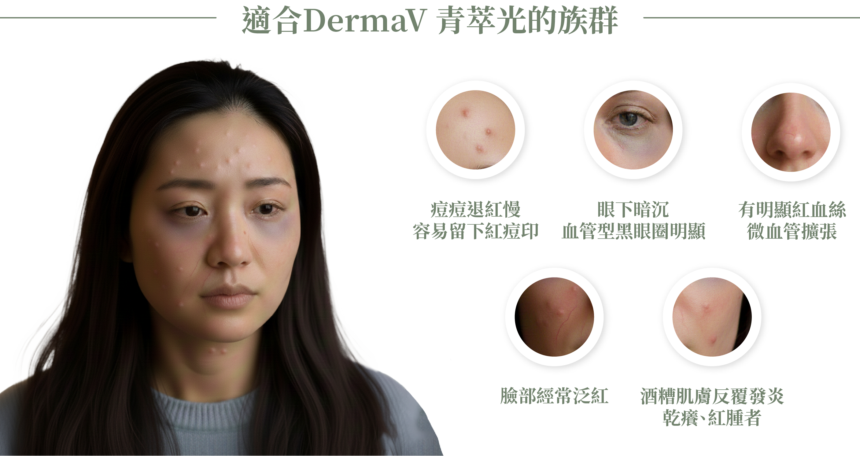  DermaV 青萃光適合族群＿辰美學
